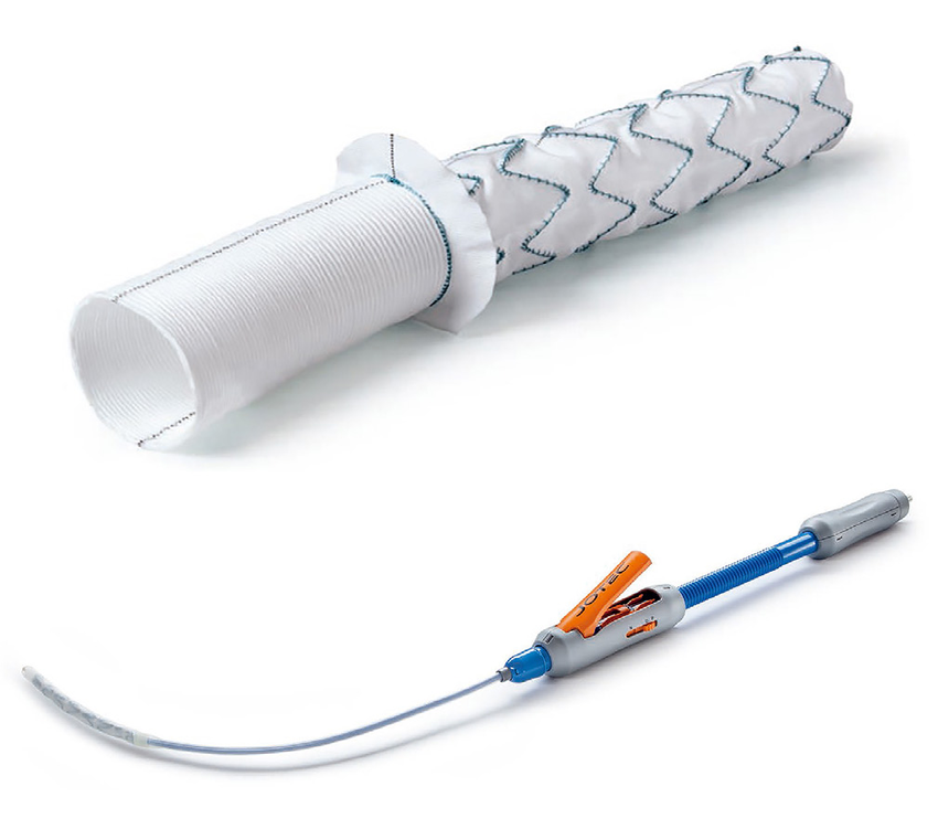 Endoprotesis Híbrida E-vita Open Plus