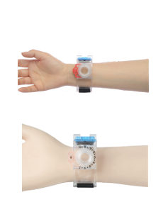 TORNIQUETE  COMPRESIVO  DE ARTERIA  RADIAL-ROTATIVO